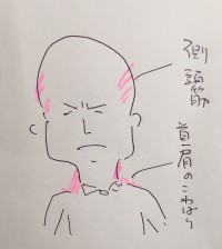こめかみ凝り